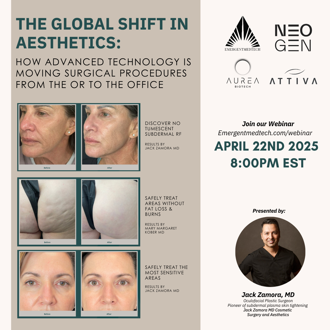 The Global Shift in Aesthetics