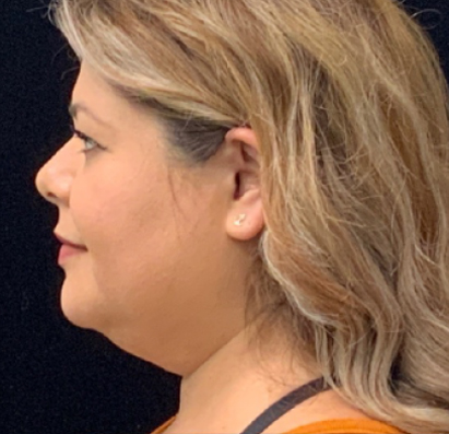 Side profile portrait of a woman with shoulder-length blonde hair wearing an orange top against a black background