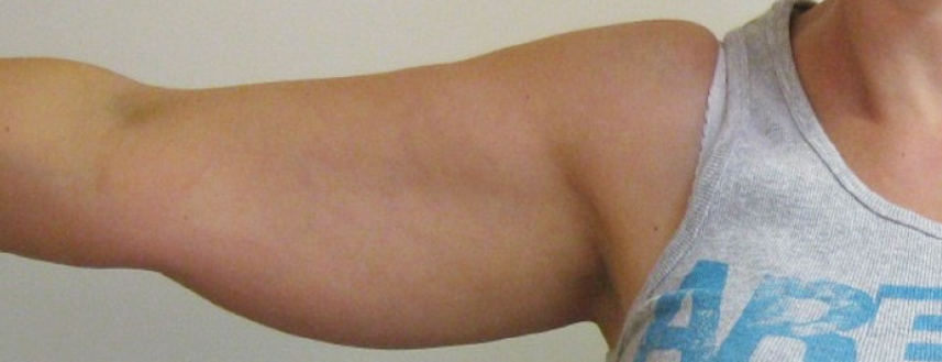 A woman’s outstretched upper arm and armpit wearing a gray sleeveless top with blue lettering