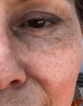Close-up of a woman's face showing eye, crow's feet, freckles, and orange beaded earring